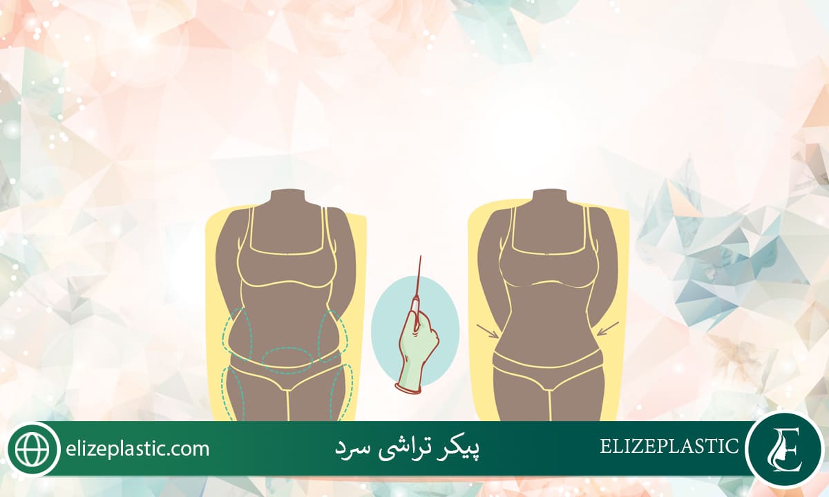 پیکر تراشی سرد